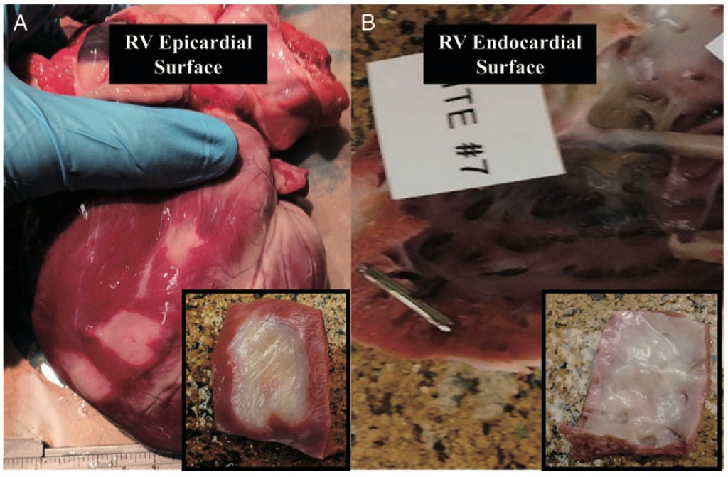 human heart image.