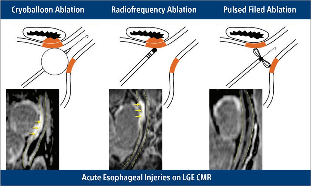 safety oesophagus graphical image