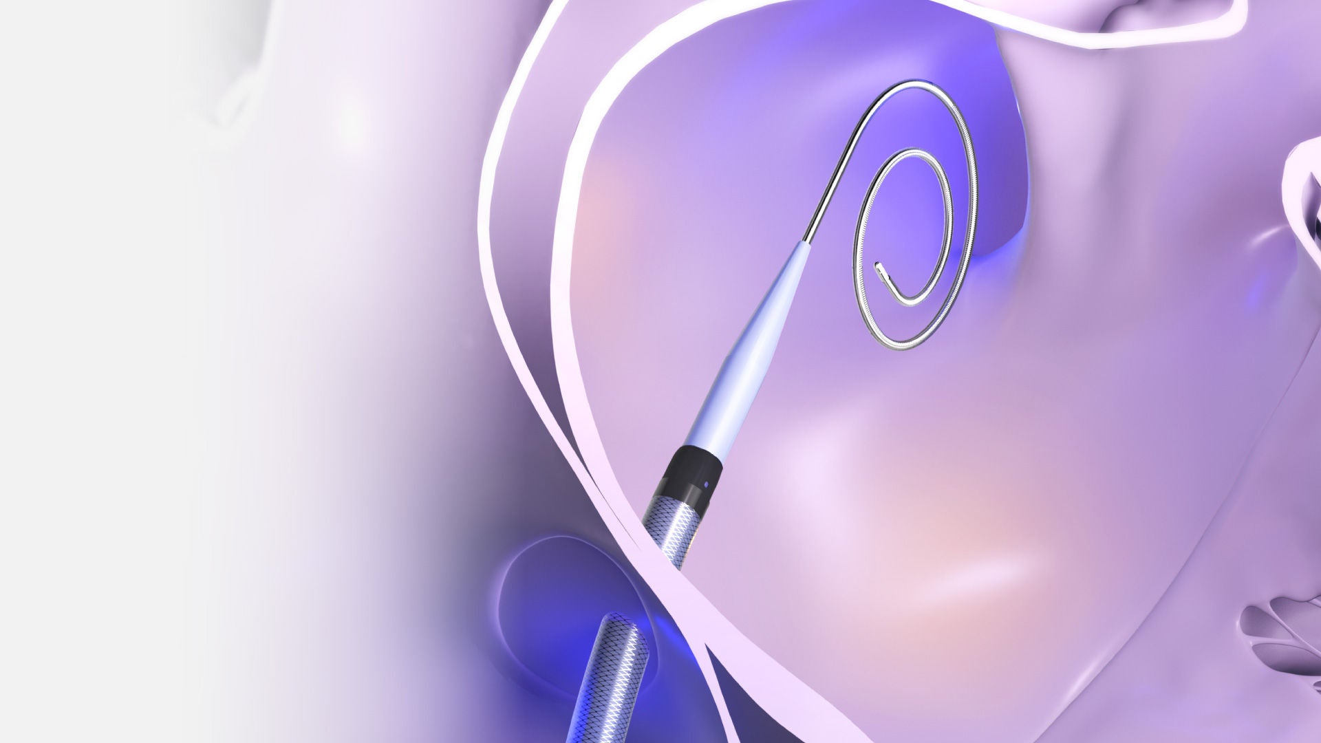 VersaCross Connect Transseptal Dilator with 3-in-1 pigtail RF wire extending from FARADRIVE Steerable Sheath.