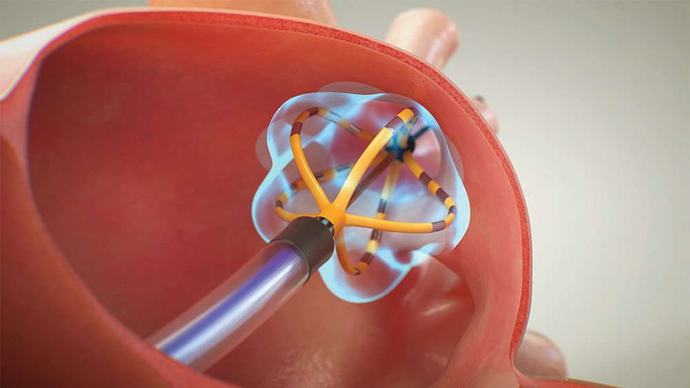 antral view animation
