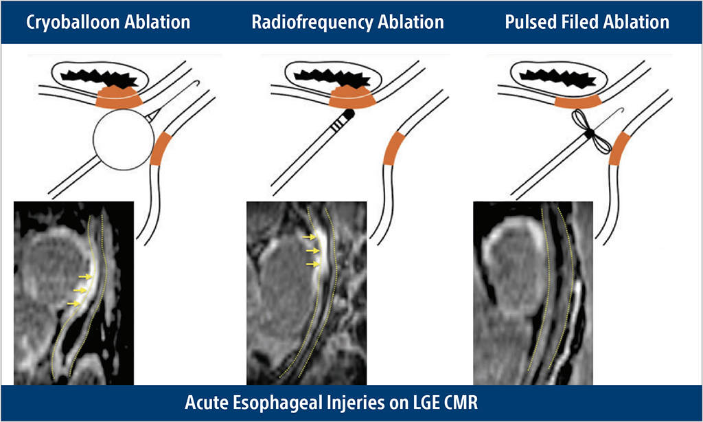 safety oesophagus graphical image