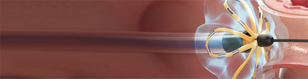 farapulse catheter in flower pose product image
