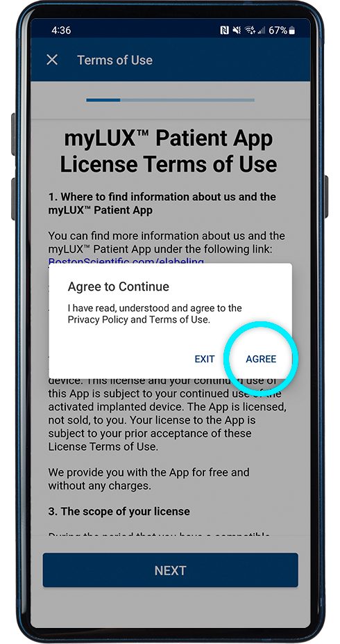 license terms of use screen with prompt to agree